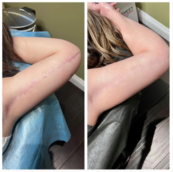 Paramedical tattooing result